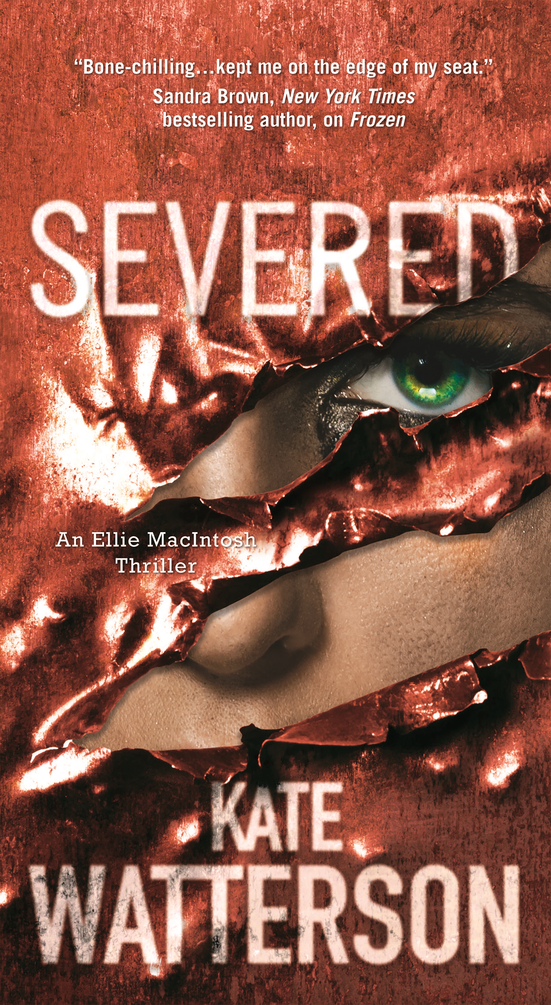 Severed by Kate Watterson